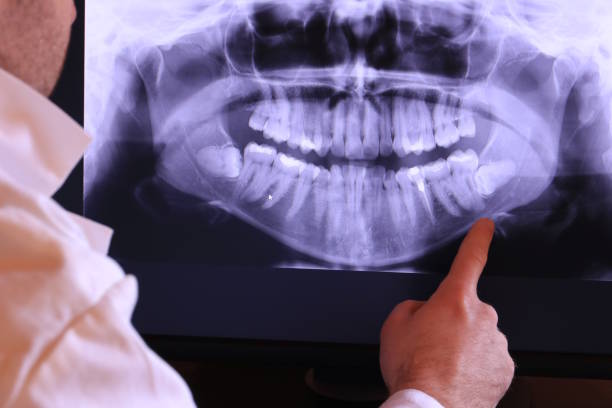 Best Emergency Dental Care for Broken or Chipped Teeth in Pine Mountain Lake, CA